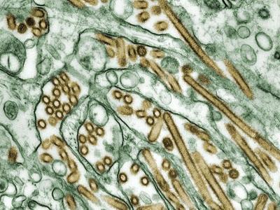 Китайские ученые нашли коронавирус в мужской сперме